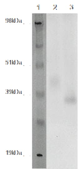 DiscoverX PathHunter CHO-K1 GPR171 -Arrestin Orphan GPCR Cell Line 2 Vials | Buy Online | DiscoverX | Fisher Scientific