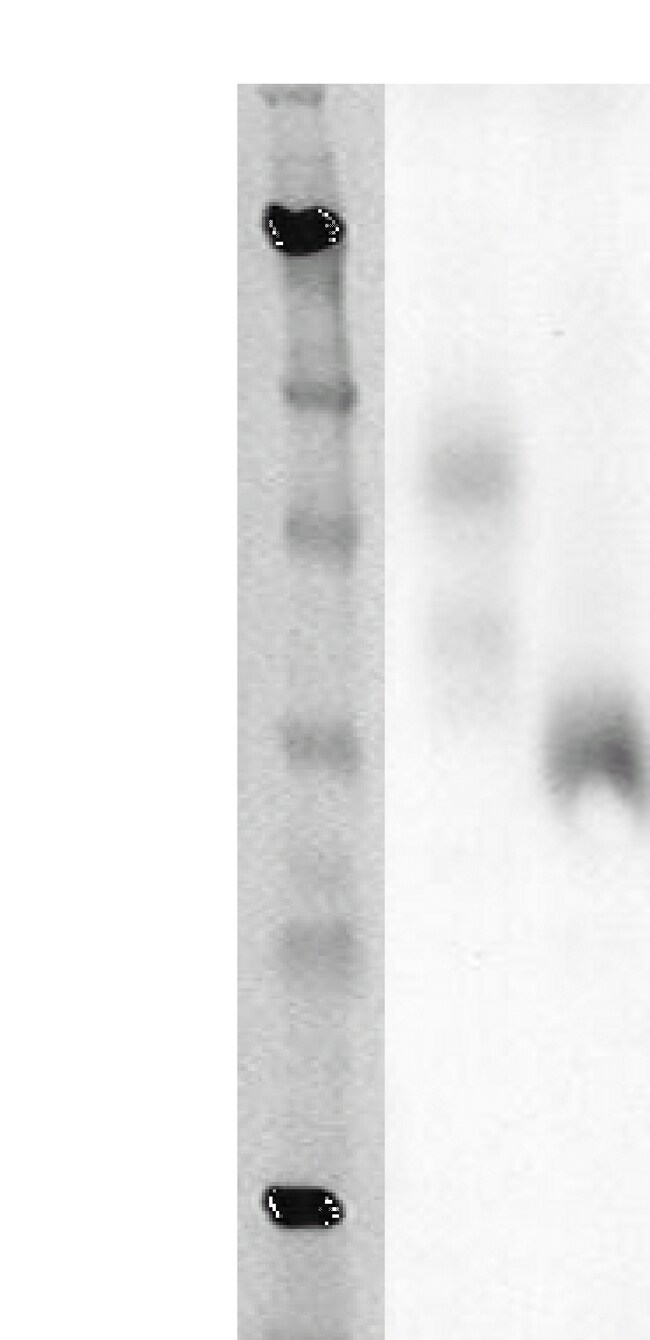 Discoverx Pathhunter Express Gpr141 Cho K1 Arrestin Orphan Gpcr Assay