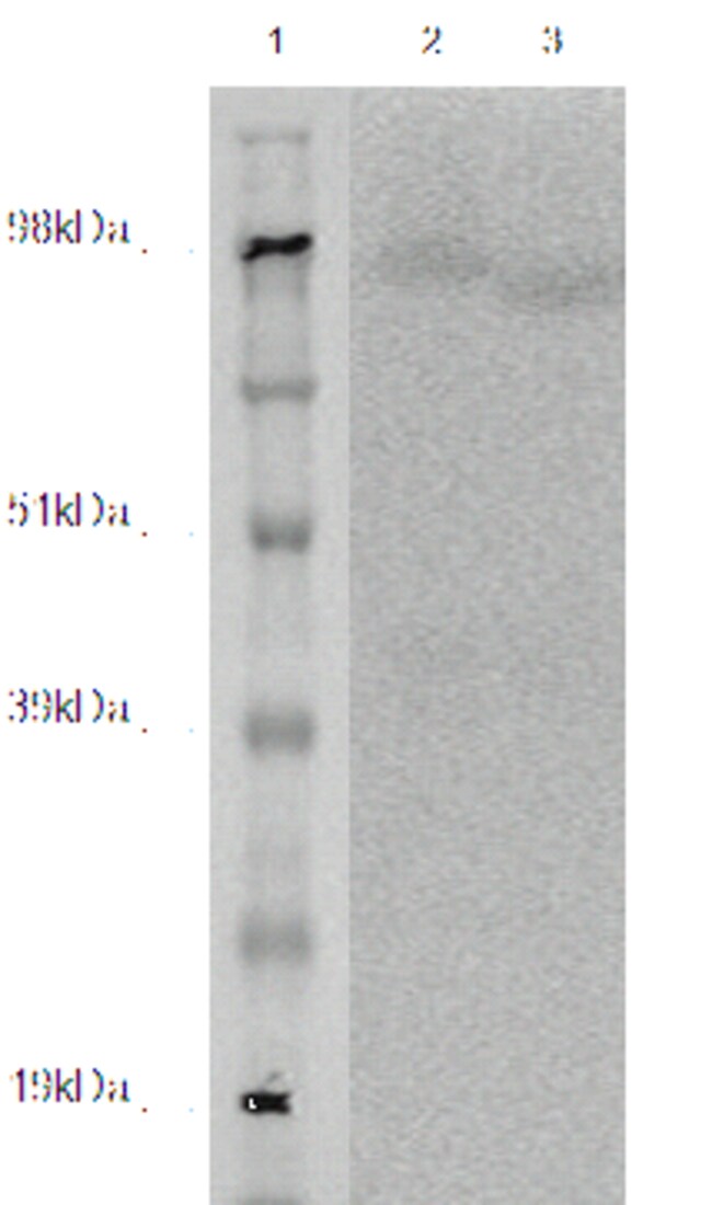 DiscoverX PathHunter eXpress LGR5 CHO-K1 -Arrestin Orphan GPCR Assay 1 ...