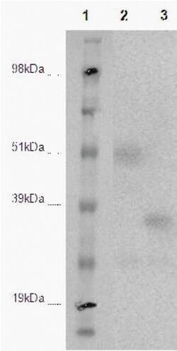 DiscoverX PathHunter eXpress DARC CHO-K1 -Arrestin Orphan GPCR Assay 200 dp (2 x 96-brunnar) | Buy Online | DiscoverX | Fisher Scientific