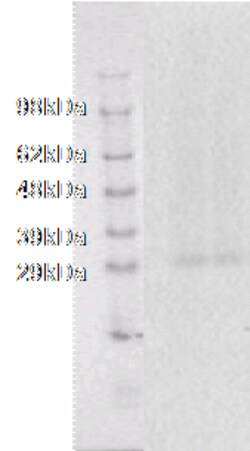 DiscoverX PathHunter eXpress GPR18 CHO-K1 -Arrestin Orphan GPCR Assay 1,000 dp (10 x 96-well) | Buy Online | DiscoverX | Fisher Scientific