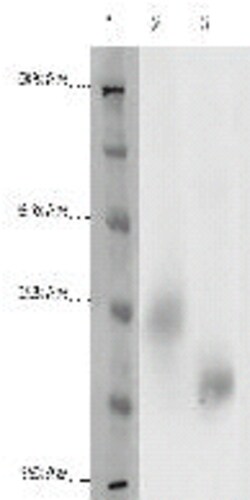 DiscoverX PathHunter eXpress GPR3 CHO-K1 -Arrestin Orphan GPCR Assay 200 dp (2 x 96-well) | Buy Online | DiscoverX | Fisher Scientific