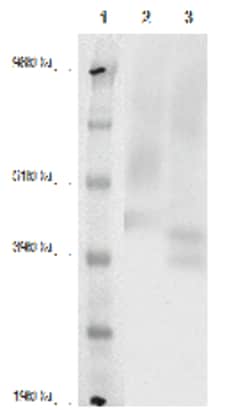 DiscoverX PathHunter eXpress P2RY8 CHO-K1 -Arrestin Orphan GPCR Assay 1,000 dp (10 x 96-well) | Buy Online | DiscoverX | Fisher Scientific
