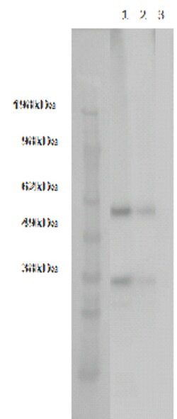 DiscoverX PathHunter CHO-K1 GPR161 -Arrestin Orphan GPCR Cell Line 2 Vials | Buy Online | DiscoverX | Fisher Scientific