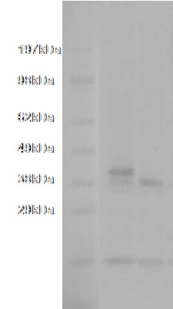 DiscoverX PathHunter eXpress TAAR5 CHO-K1 -Arrestin Orphan GPCR Assay 200 dp (2 x 96-well) | Buy Online | DiscoverX | Fisher Scientific