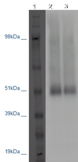 DiscoverX PathHunter CHO-K1 GPR101 -Arrestin Orphan GPCR Cell Line 2 ...