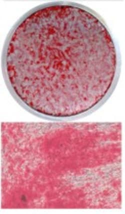 Alizarin-Red Staining Solution, 100 mL, G-Biosciences 100 mL | Buy Online | G-Biosciences | Fisher Scientific