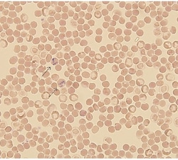 Reticulocyte Stain, 100 mL, G-Biosciences