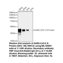 Nucleocapsid Protein Rabbit, anti-SARS-CoV-2, Unconjugated, MP Biomedicals 100 &mu;L | Buy Online | MP Biomedicals, Inc | Fisher Scientific