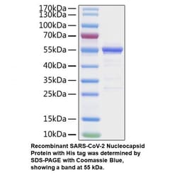 MP Biomedicals&trade;&nbsp;Recombinant SARS-CoV-2 Nucleocapsid Protein (His tag)