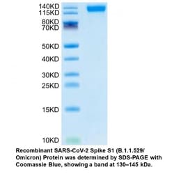 MP Biomedicals&trade;&nbsp;Recombinant SARS-CoV-2 Spike S1 (B.1.1.529/Omicron) Protein (His tag)