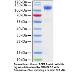 MP Biomedicals&trade;&nbsp;Recombinant Human ACE2 Protein (His tag)