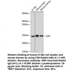 CD9 Rabbit, anti-Human, Unconjugated, MP Biomedicals 100 &mu;L | Buy Online | MP Biomedicals, Inc | Fisher Scientific