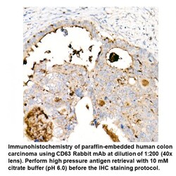 CD63 Rabbit, anti-Human, Unconjugated, MP Biomedicals 100 &mu;L | Buy Online | MP Biomedicals, Inc | Fisher Scientific