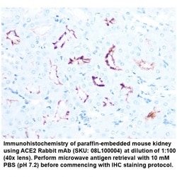 ACE2 Rabbit, anti-Human, Unconjugated, MP Biomedicals Quantity: 100 &mu;L:Antibodies,