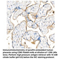 CD63 Rabbit, anti-Human, Unconjugated, MP Biomedicals 100 &mu;L | Buy Online | MP Biomedicals, Inc | Fisher Scientific