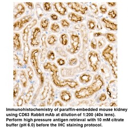 CD63 Rabbit, anti-Human, Unconjugated, MP Biomedicals 100 &mu;L | Buy Online | MP Biomedicals, Inc | Fisher Scientific