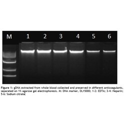 MP Biomedicals&trade;&nbsp;SPINeasy&trade; DNA Kit for Blood Isolation Technology: Spin Column 