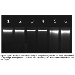 MP Biomedicals&trade;&nbsp;SPINeasy&trade; DNA Kit for Blood Isolation Technology: Spin Column 