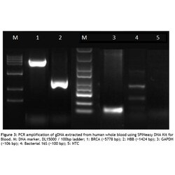 MP Biomedicals&trade;&nbsp;SPINeasy&trade; DNA Kit for Blood Isolation Technology: Spin Column 