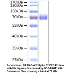 MP Biomedicals&trade;&nbsp;Recombinant SARS-CoV-2 Spike S2 ECD Protein (His tag)