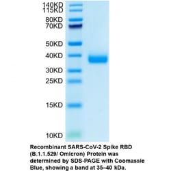 MP Biomedicals&trade;&nbsp;Recombinant SARS-CoV-2 Spike RBD (B.1.1.529/Omicron) Protein (His tag)