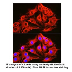 Mouse anti- -Tubulin, MP Biomedicals Quantity: 100 &mu;L:Antibodies, Monoclonal