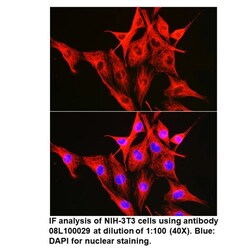 Mouse anti- -Tubulin, MP Biomedicals Quantity: 100 &mu;L:Antibodies, Monoclonal