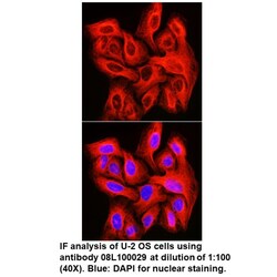 Mouse anti- -Tubulin, MP Biomedicals Quantity: 100 &mu;L:Antibodies, Monoclonal