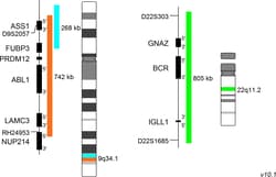 MetaSystems XL BCR/ABL1/ASS DNA Probe