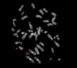 MetaSystems CL TP53 DNA Probe
