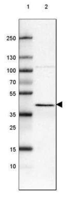 ACAA1 Antibody (CL2662), Novus Biologicals 0.1 mL, Unconjugated:Antibodies,