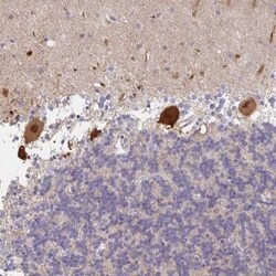 AMPD2 Antibody, Novus Biologicals 0.1 mL, Unconjugated:Antibodies, Polyclonal