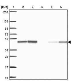 Acylglycerol Kinase Antibody, Novus Biologicals 25 &mu;L, Unconjugated:Antibodies,