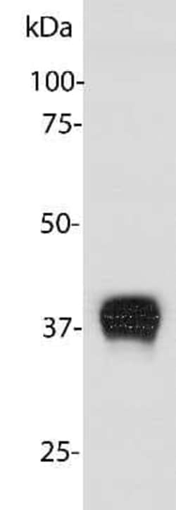 Aldolase C Antibody (E9), Novus Biologicals:Antibodies:Primary Antibodies