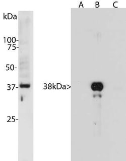 Aurora B Antibody (6G2), Novus Biologicals:Antibodies:Primary Antibodies
