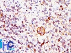 Bax Antibody (2D2) - IHC-Prediluted, Novus Biologicals 7 mL, Unconjugated:Antibodies,