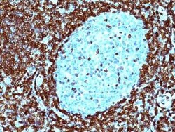 Bcl-2 Antibody (124) - IHC-Prediluted, Novus Biologicals 7 mL, Unconjugated:Antibodies,
