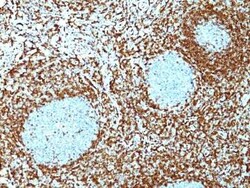 Bcl-2 Antibody (124) - IHC-Prediluted, Novus Biologicals 7 mL, Unconjugated:Antibodies,