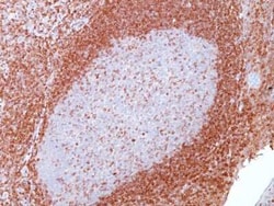 Bcl-2 Antibody (SPM117) - IHC-Prediluted, Novus Biologicals 7 mL, Unconjugated:Antibodies,