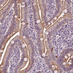 C6orf106 Antibody, Novus Biologicals 0.1 mL, Unconjugated:Antibodies, Polyclonal