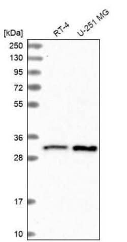 CCDC124 Antibody, Novus Biologicals:Antibodies:Primary Antibodies