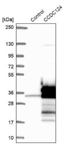 CCDC124 Antibody, Novus Biologicals:Antibodies:Primary Antibodies