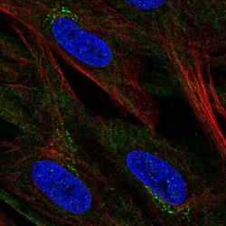 CCDC71L Antibody, Novus Biologicals 25 &mu;L, Unconjugated:Antibodies,