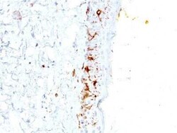 CD1a Antibody (C1A/711) - IHC-Prediluted, Novus Biologicals 7 mL, Unconjugated:Antikörper