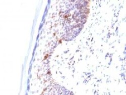 CD1a Antibody (C1A/711) - IHC-Prediluted, Novus Biologicals 7 mL, Unconjugated:Antikörper