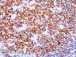 CD20 Antibody (IGEL/1497R), Novus Biologicals:Antibodies:Primary Antibodies
