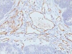 CD31/PECAM-1 Antibody (C31.3 + JC/70A) - IHC-Prediluted, Novus Biologicals