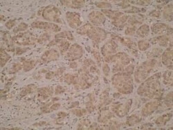 CD40/TNFRSF5 Antibody (T8P2G4 A6) - BSA Free, Novus Biologicals:Antibodies:Primary