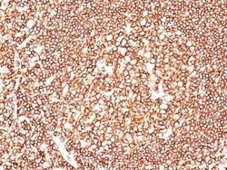 CD45 Antibody (2B11 + PD7/26) - IHC-Prediluted, Novus Biologicals 7 mL,
